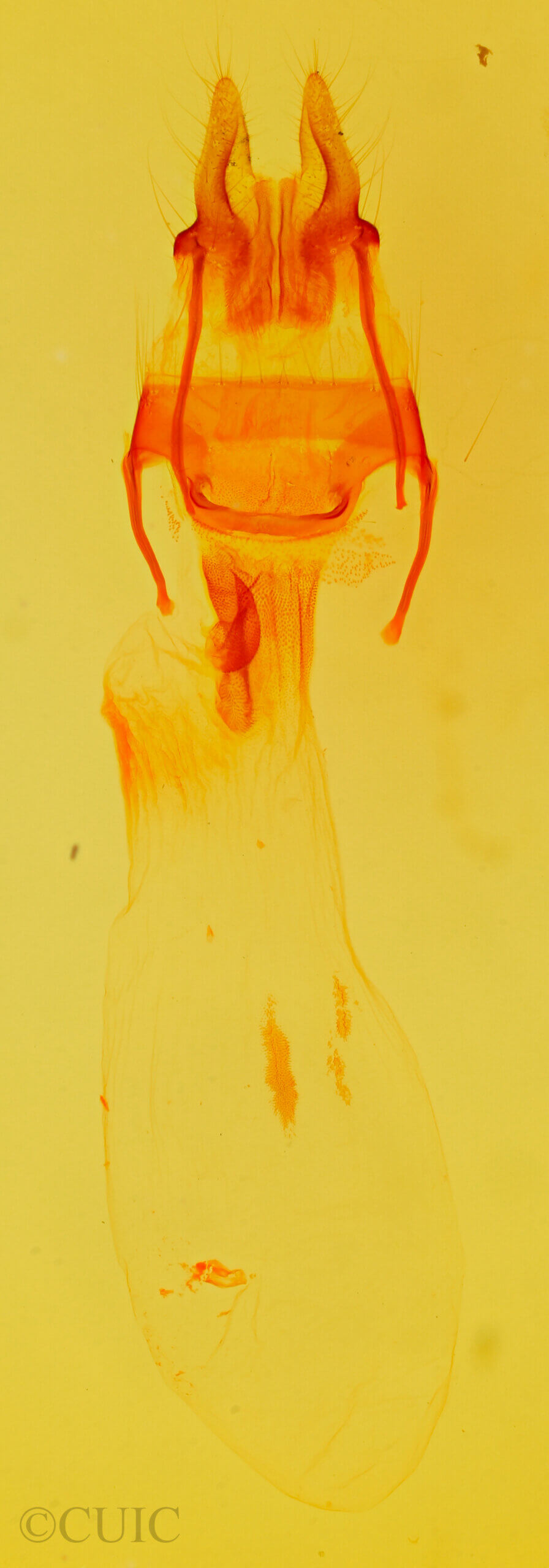 genitalia view of adult Lemmeria digitalis