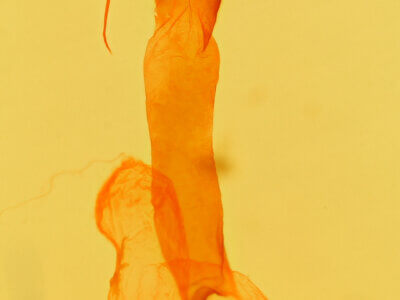 genitalia view of adult Lacinipolia tricornuta