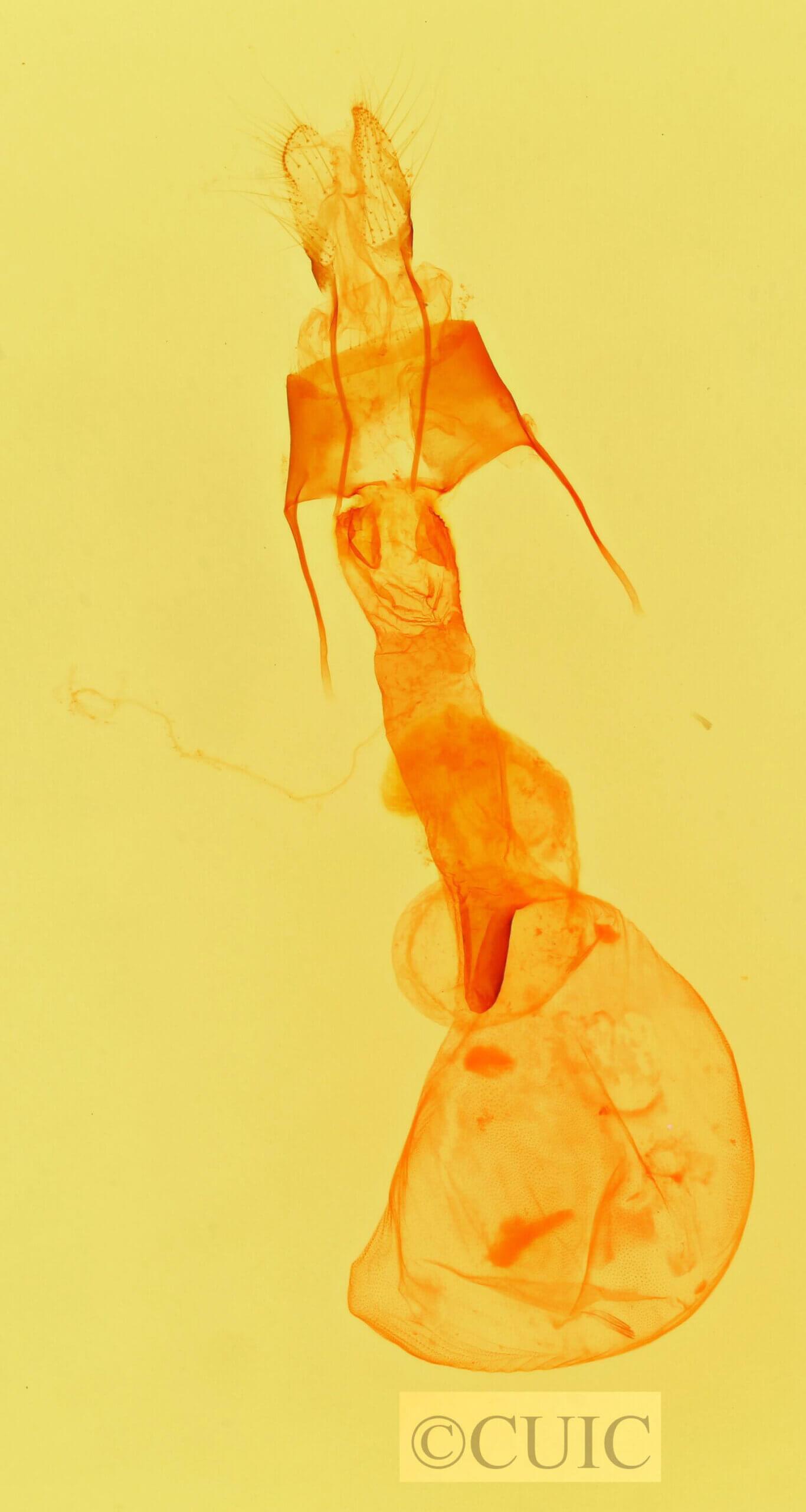 genitalia view of adult Lacinipolia strigicollis