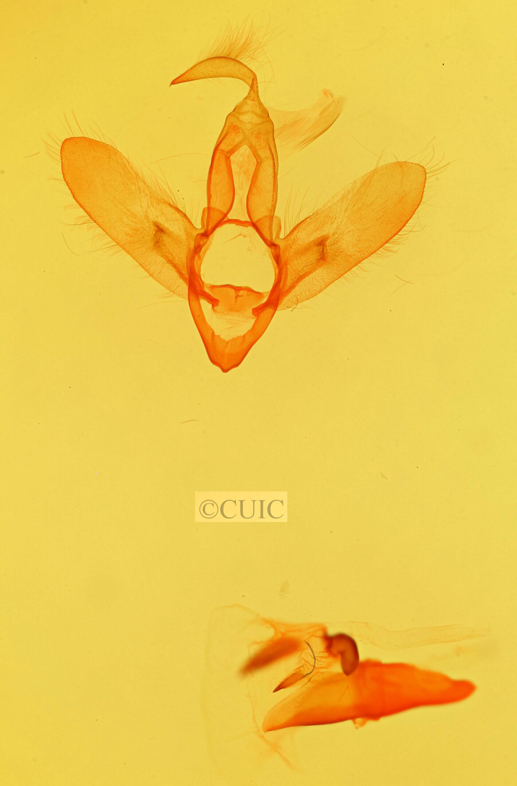 genitalia view of adult Azeta sp.