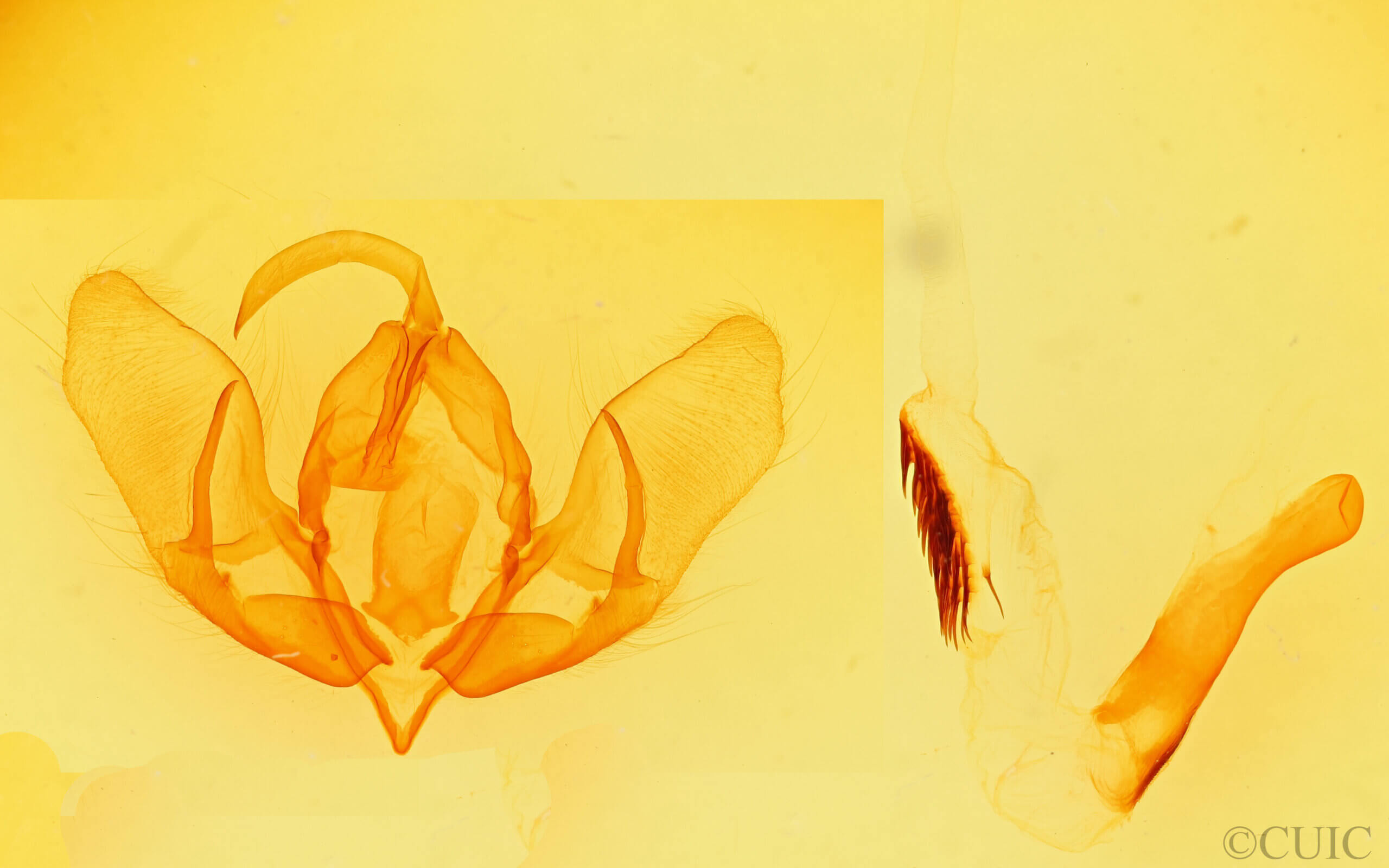 genitalia view of adult Acronicta americana eldora