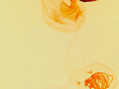 genitalia view of adult Collomena inflexa