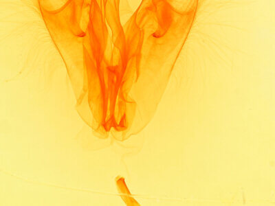 genitalia view of adult Collomena inflexa