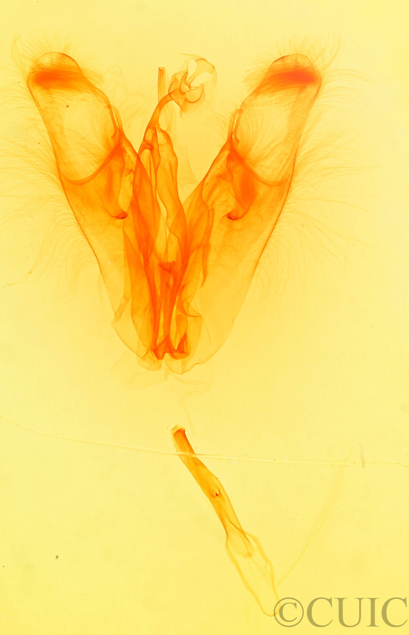 genitalia view of adult Collomena inflexa