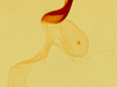 genitalia view of adult Motya abseuzalis