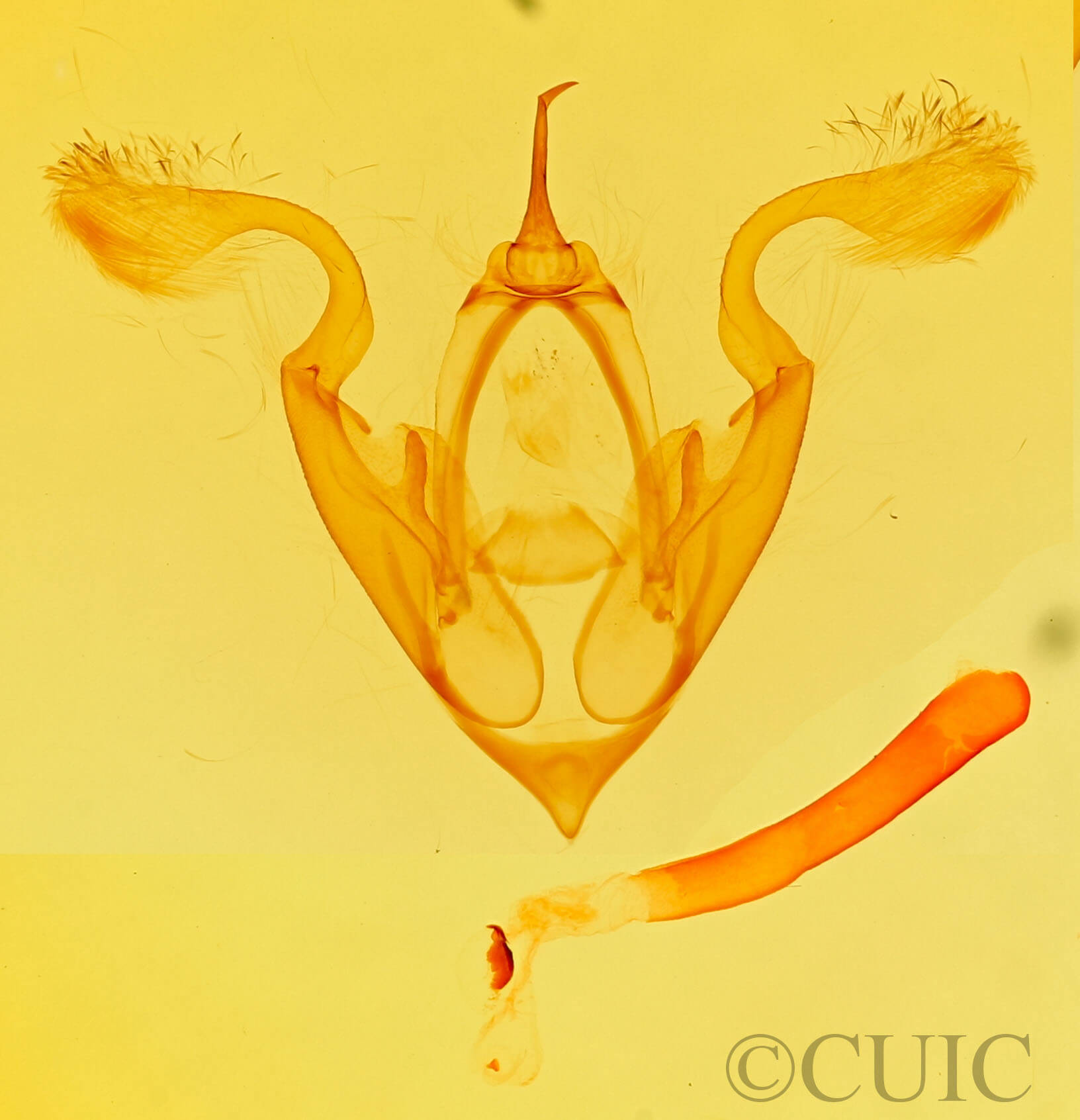 genitalia view of adult Eutelia pulcherrimus