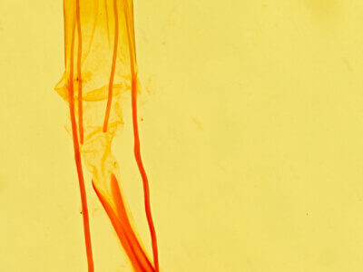 genitalia view of adult Idia aemula