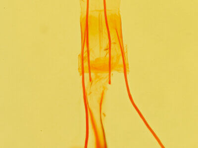 genitalia view of adult Idia aemula