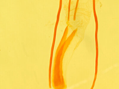 genitalia view of adult Idia aemula