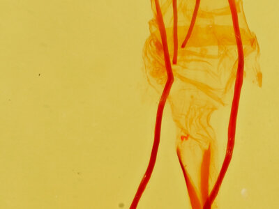 genitalia view of adult Idia aemula