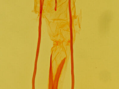 genitalia view of adult Idia aemula