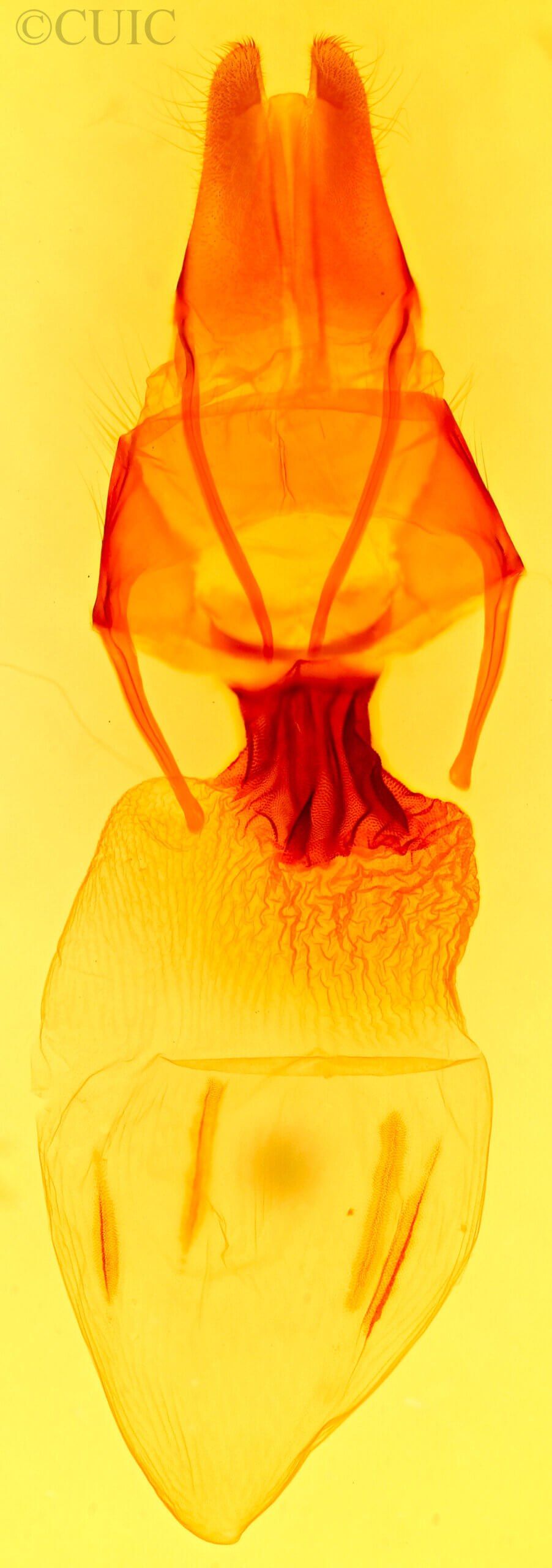 genitalia view of adult Apamea cogitata