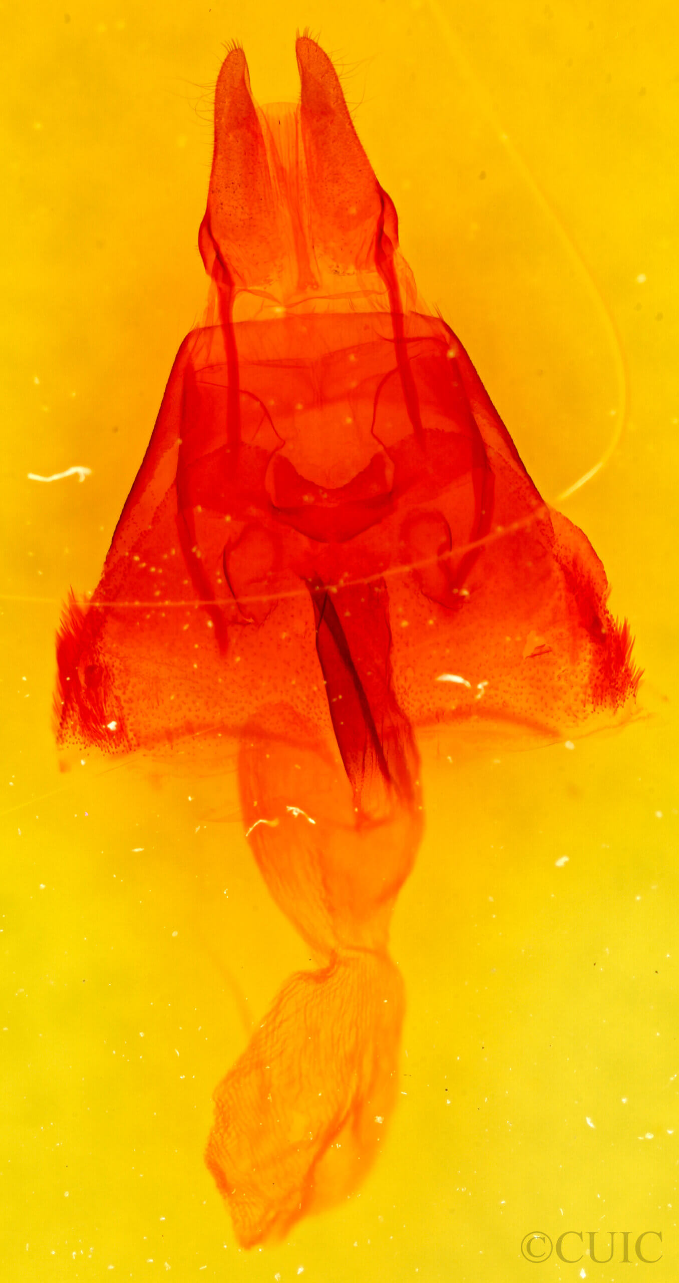 genitalia view of adult Apamea scolopacina