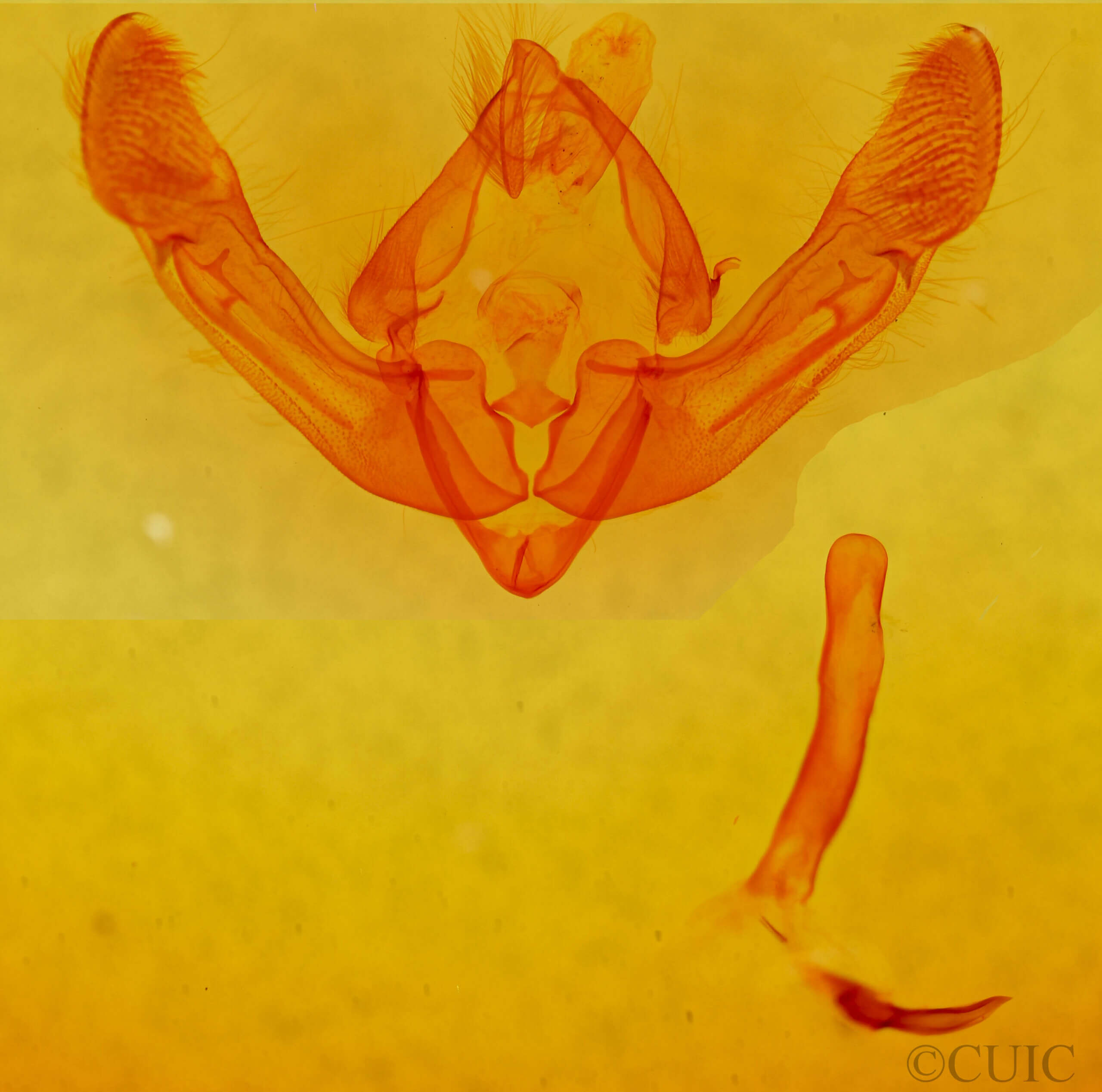 genitalia view of adult Pabulatrix pabulatricula