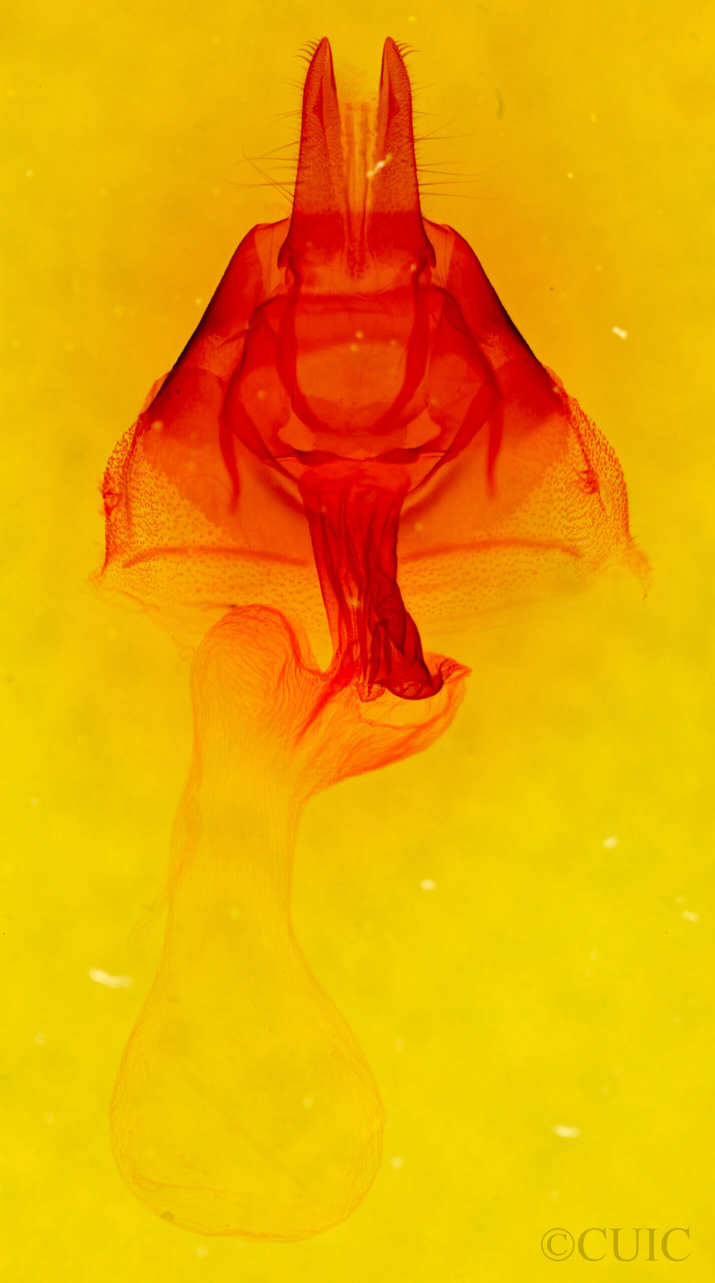 genitalia view of adult Apamea unanimis