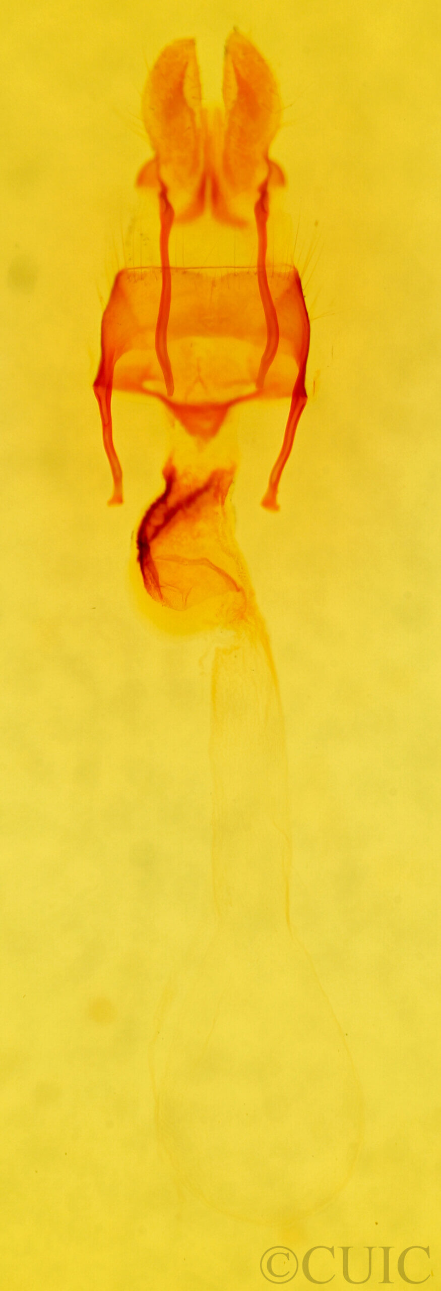 genitalia view of adult Mesapamea secalis