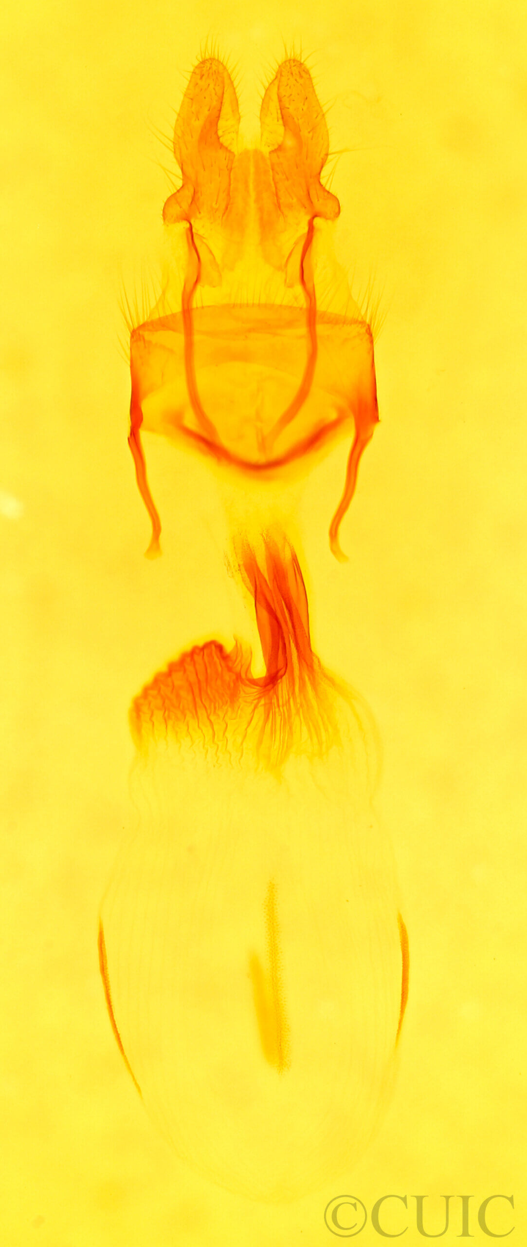 genitalia view of adult Lateroligia ophiogramma