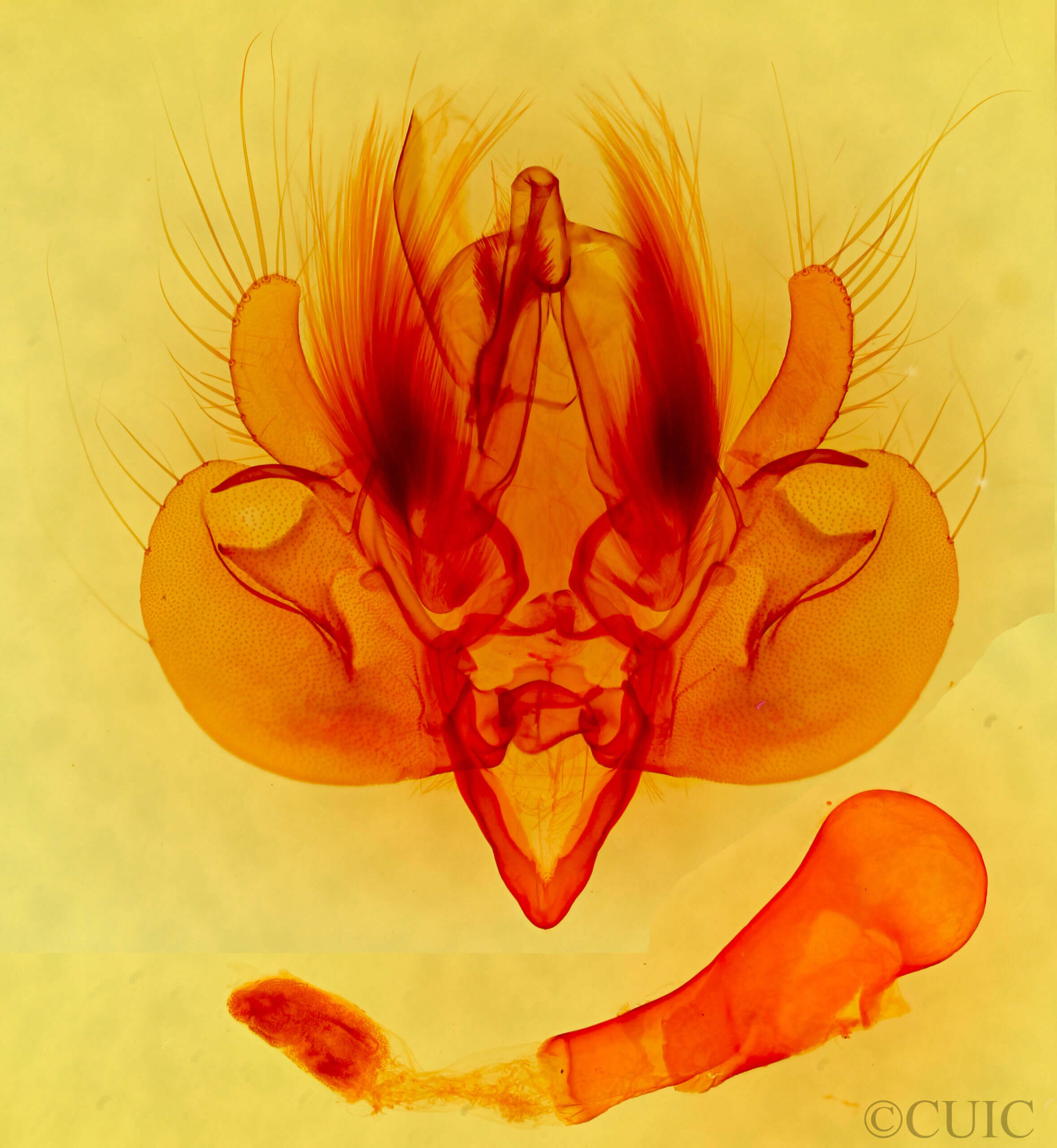 genitalia view of adult Leucania sp.