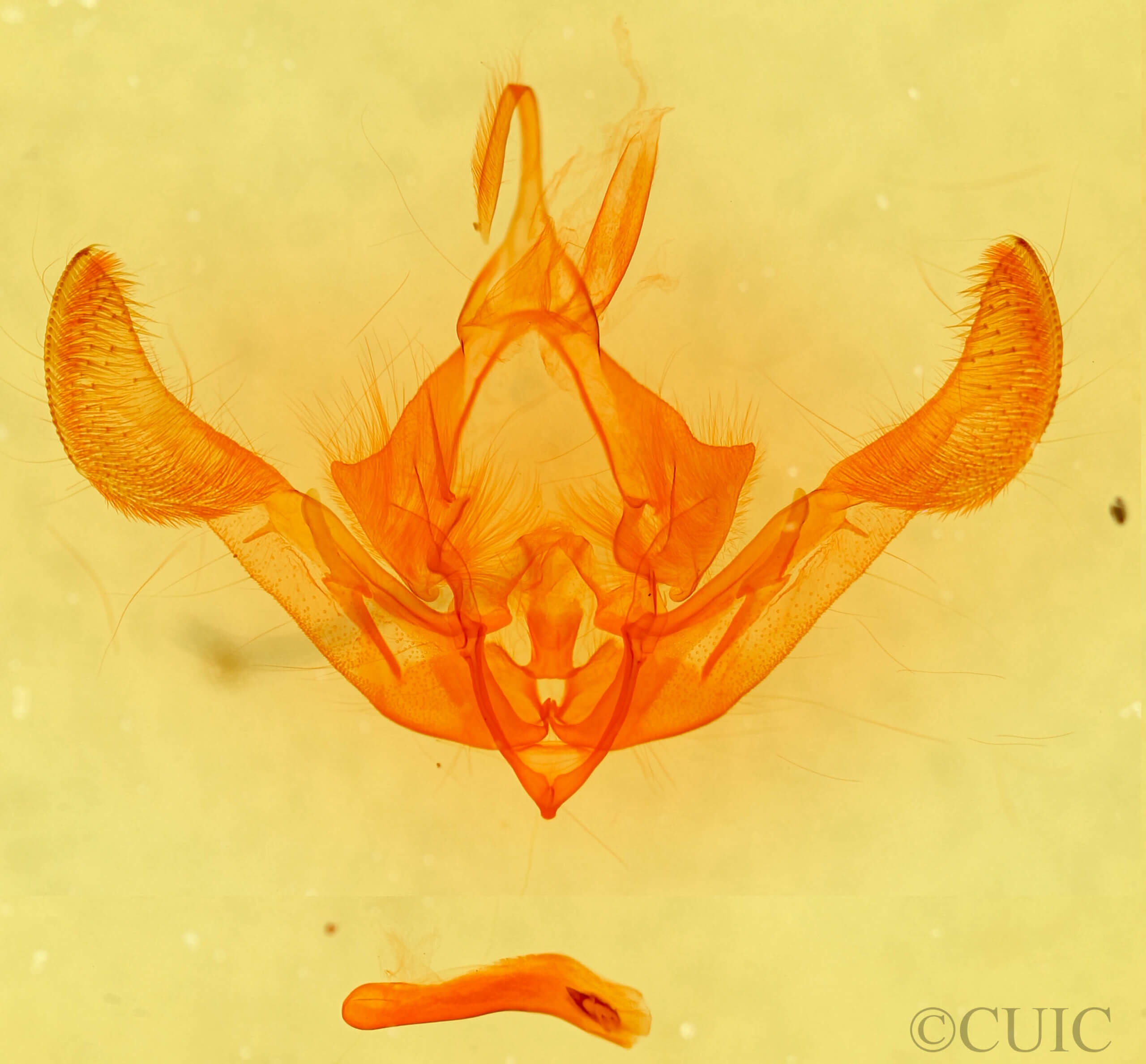 genitalia view of adult Parastichtis suspecta