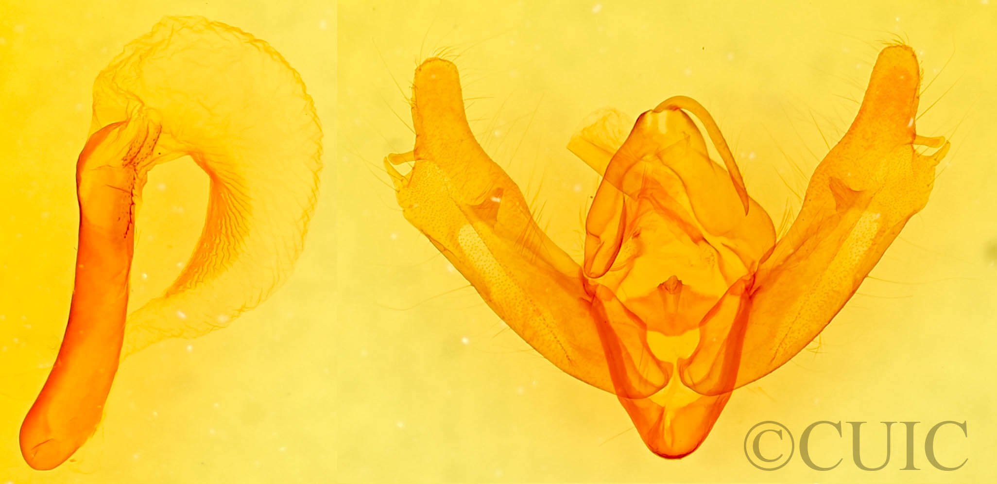 genitalia view of adult Xestia oblata