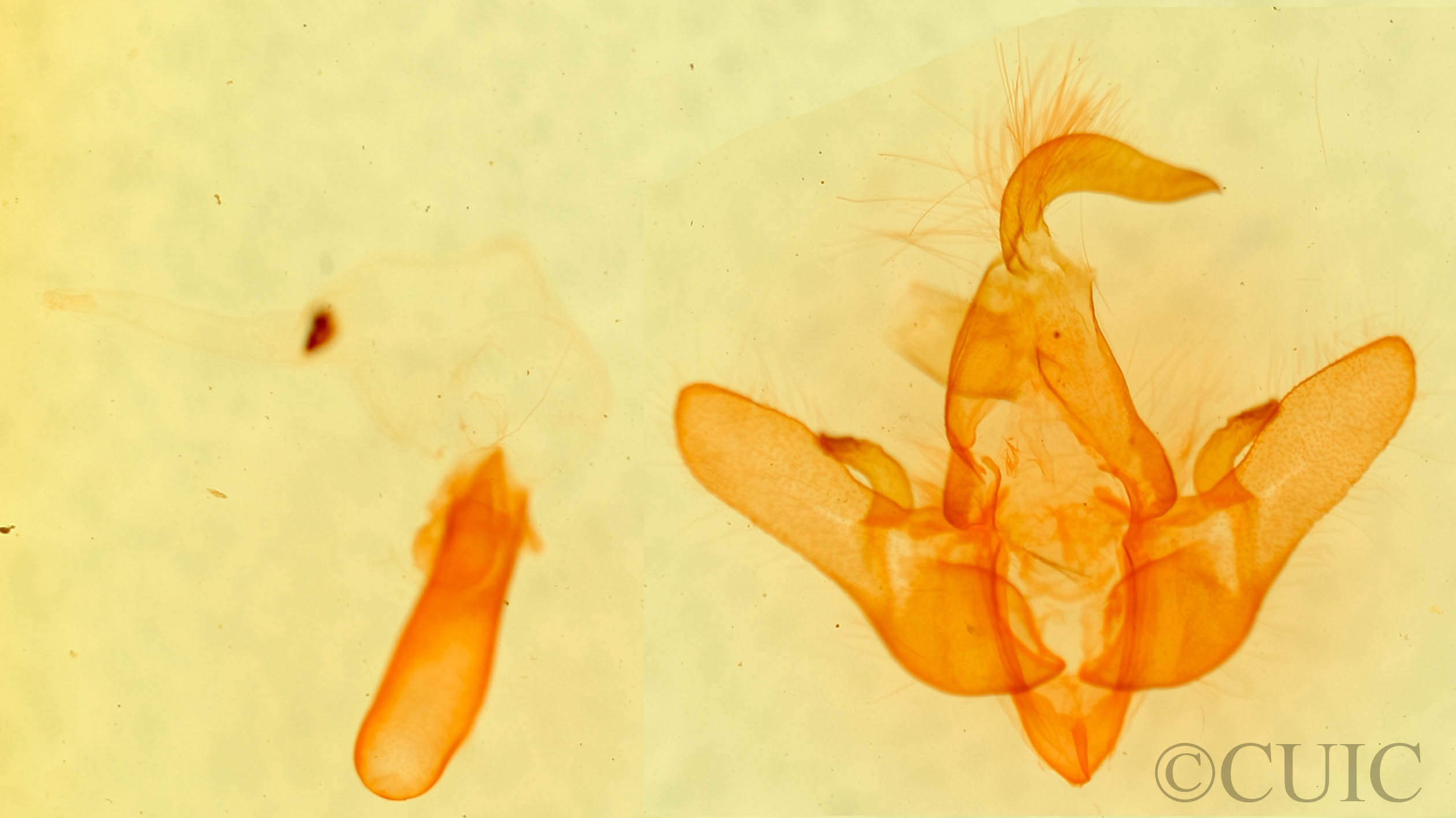 genitalia view of adult Cosmia sp.