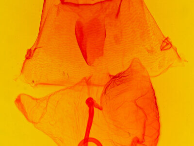 genitalia view of adult Asota ? ochreobasis ?