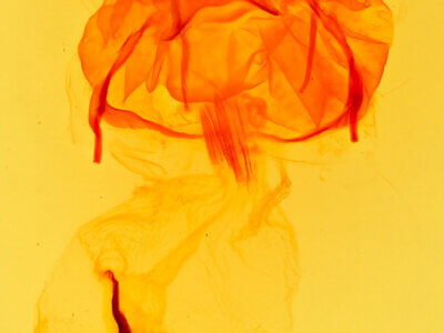 genitalia view of adult Asota caricae