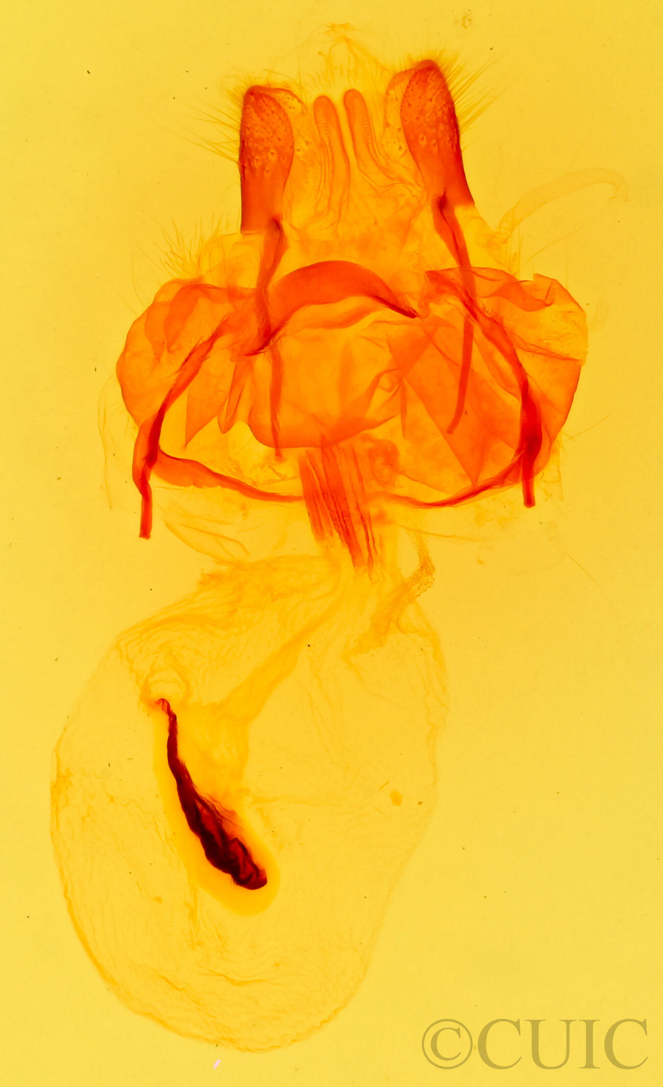 genitalia view of adult Asota caricae