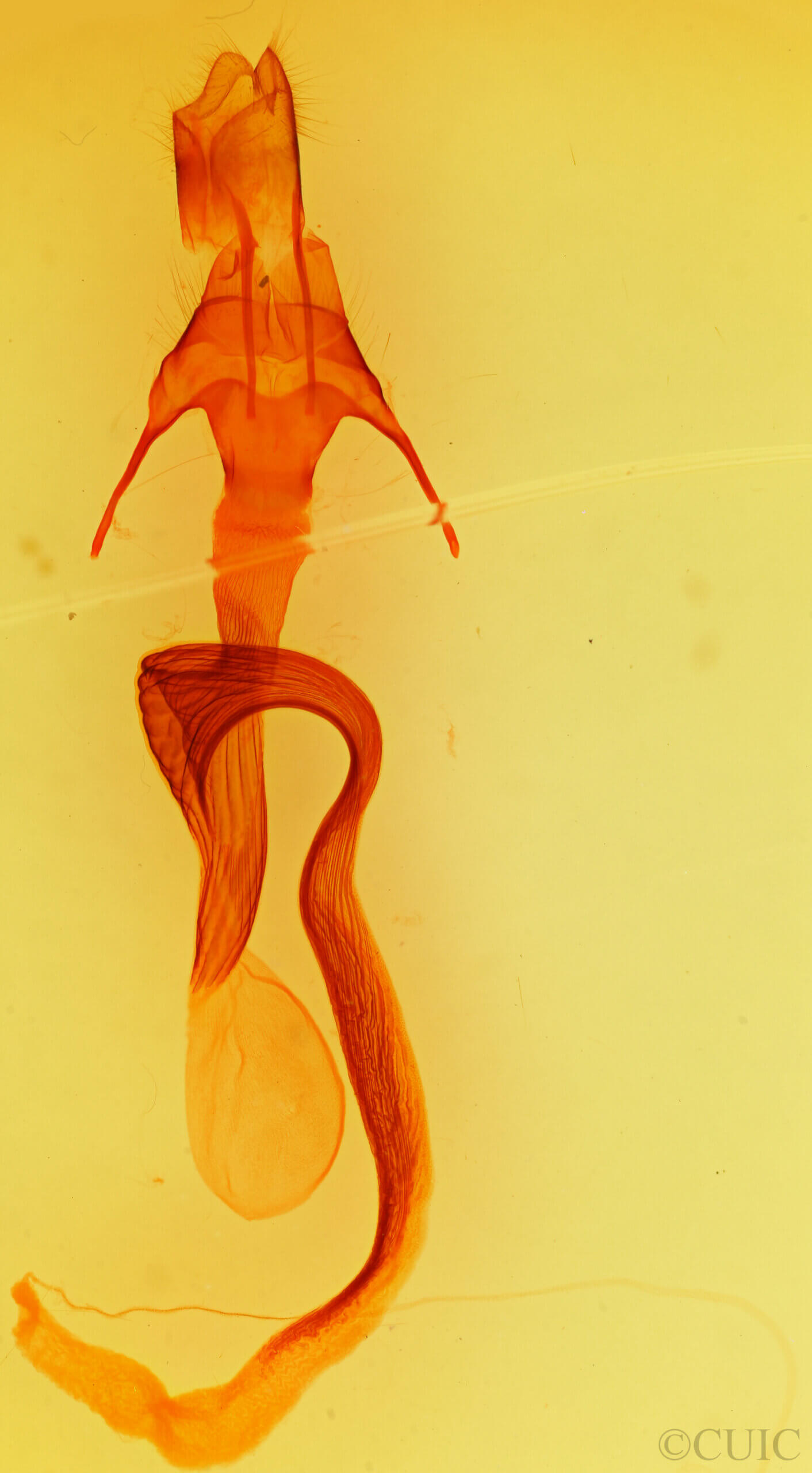 genitalia view of adult Mythimna unipuncta