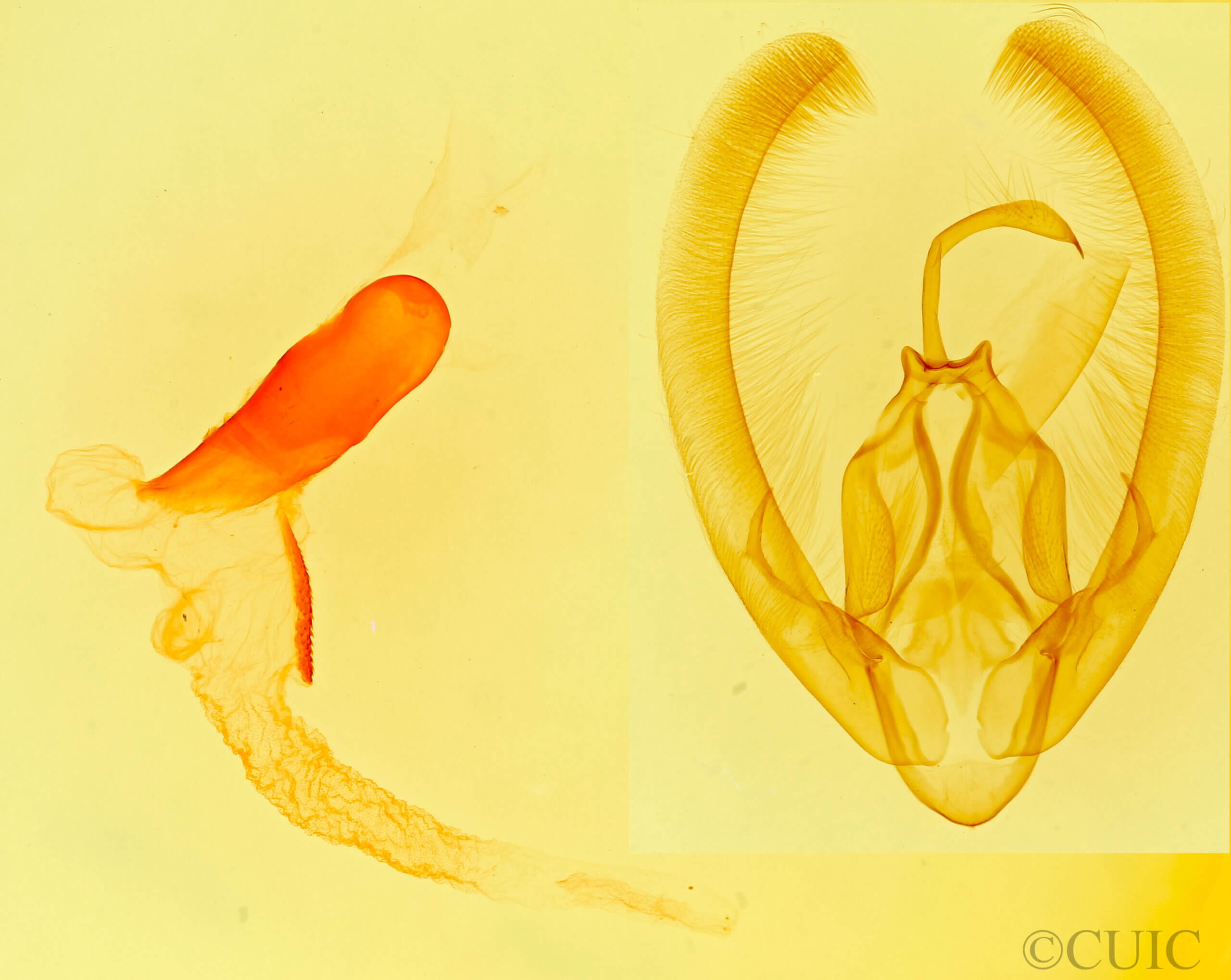 genitalia view of adult Condica albolabes