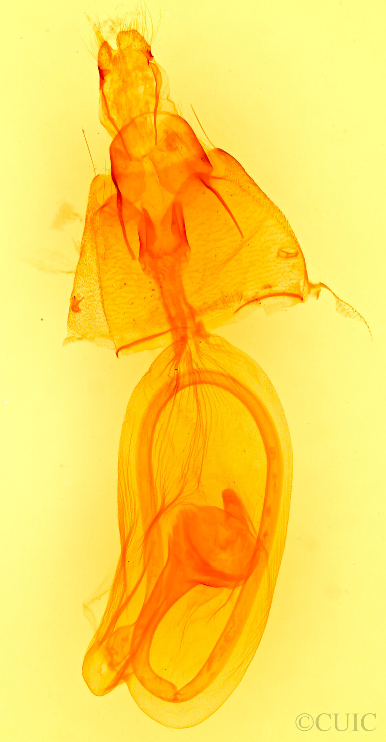 genitalia view of adult Condica albolabes