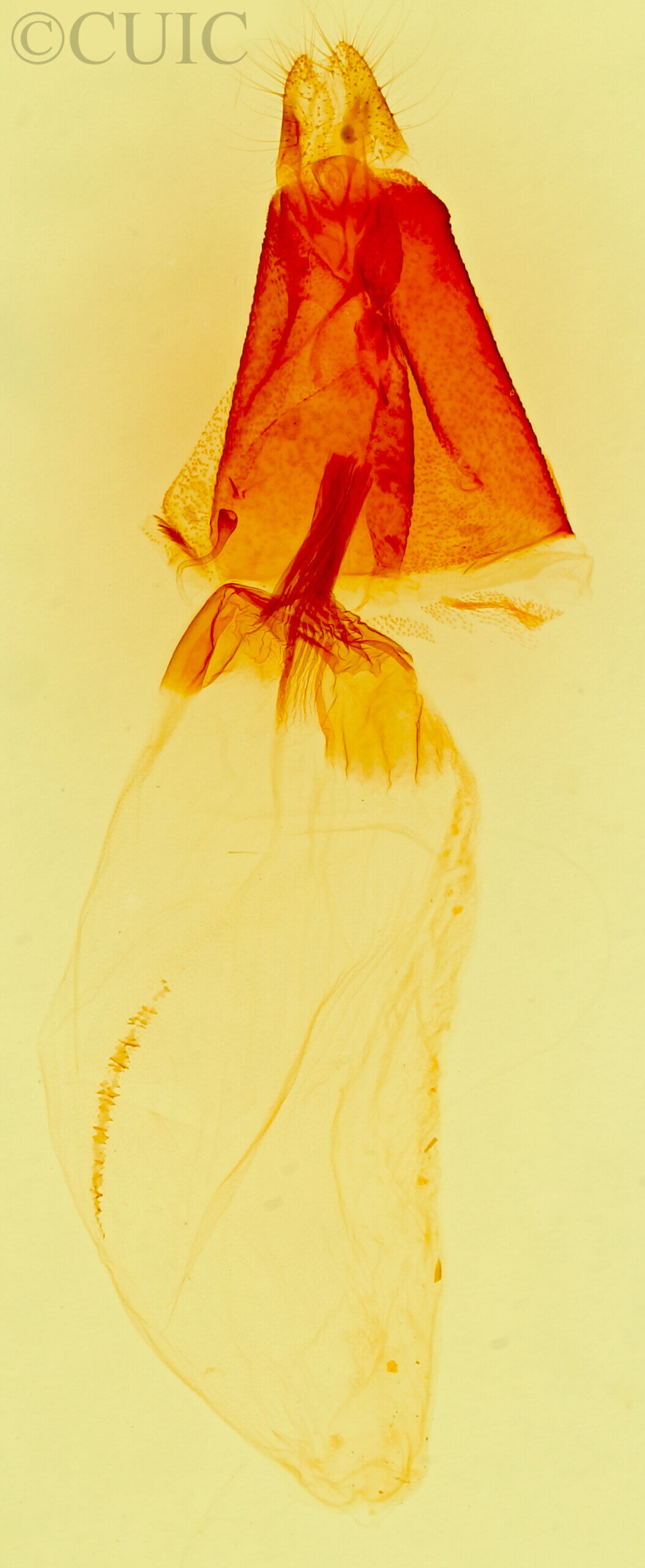 genitalia view of adult Hemigrotella argenteostriata