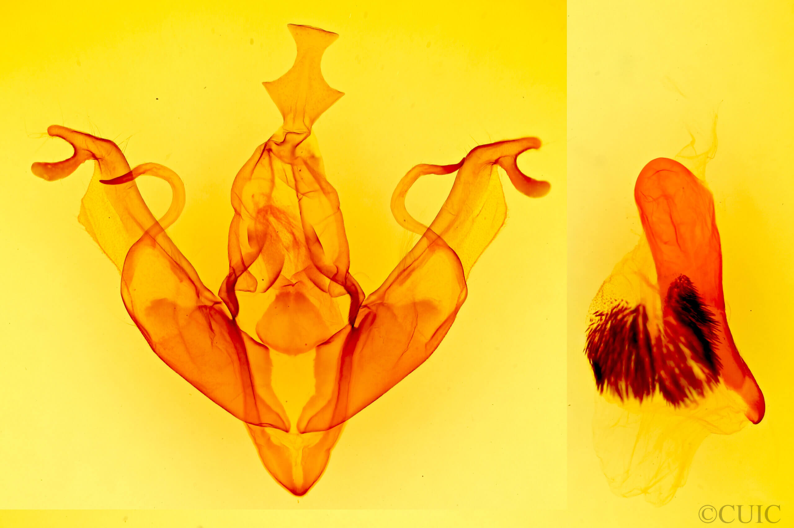 genitalia view of adult Xylena thoracica