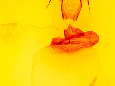 genitalia view of adult Xylena thoracica