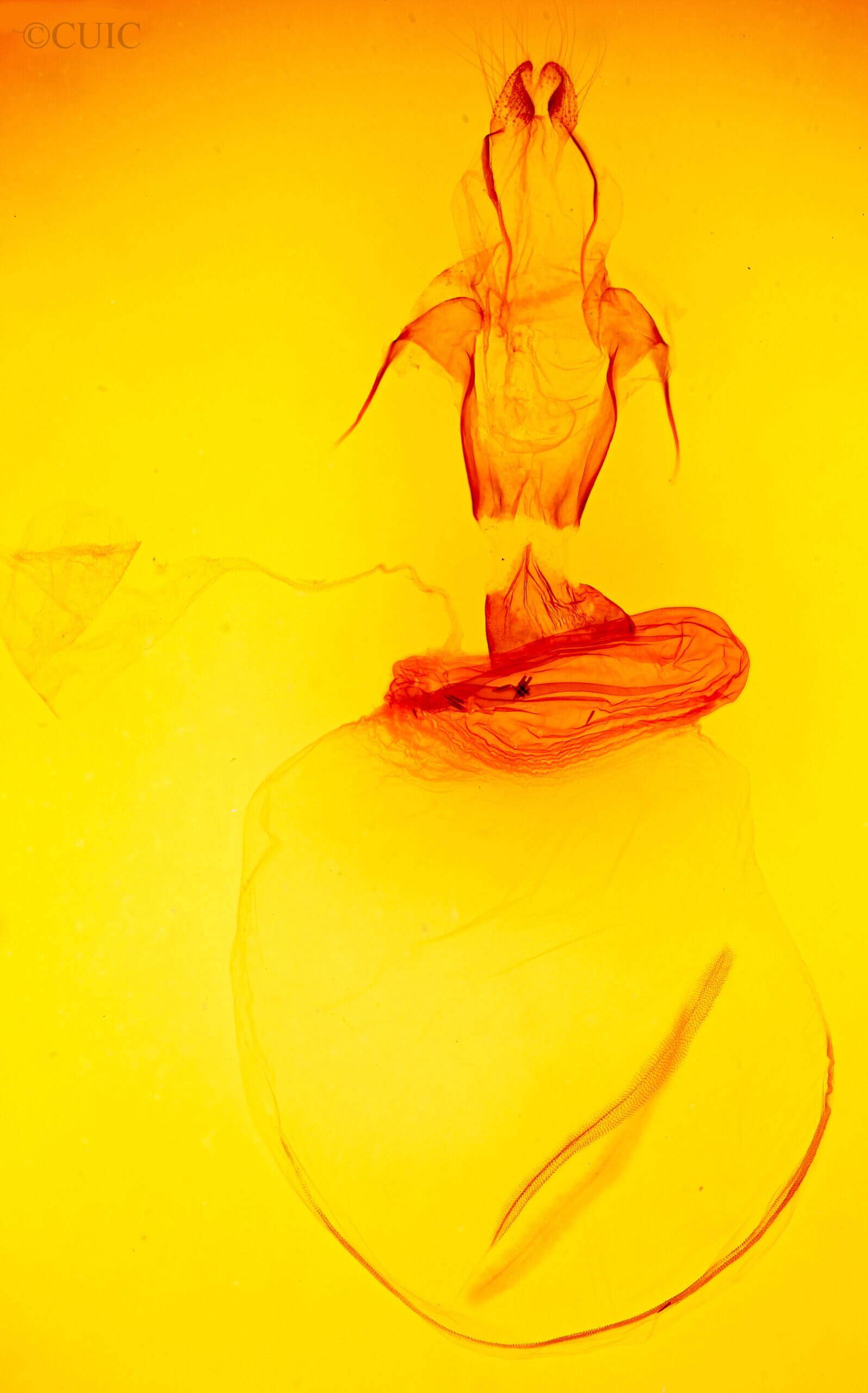 genitalia view of adult Xylena thoracica