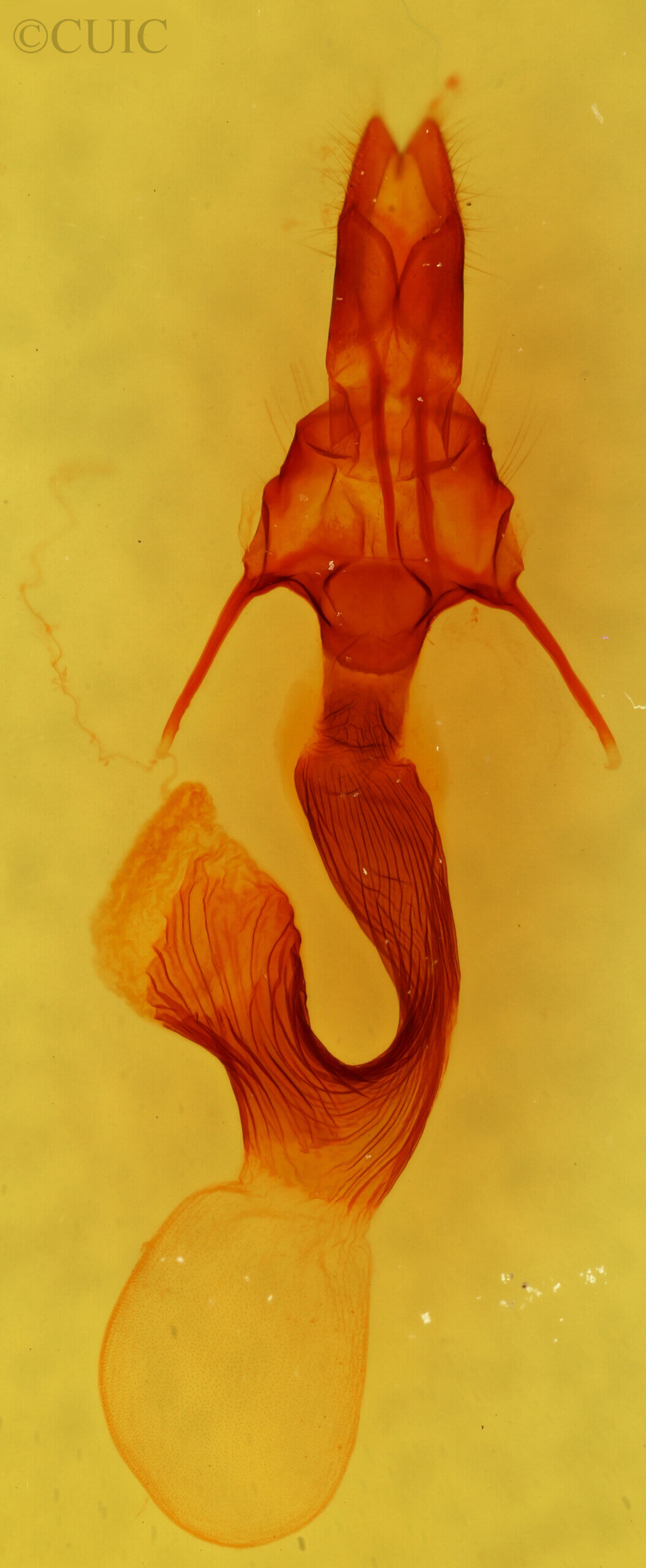 genitalia view of adult Leucania latiuscula (incognita)