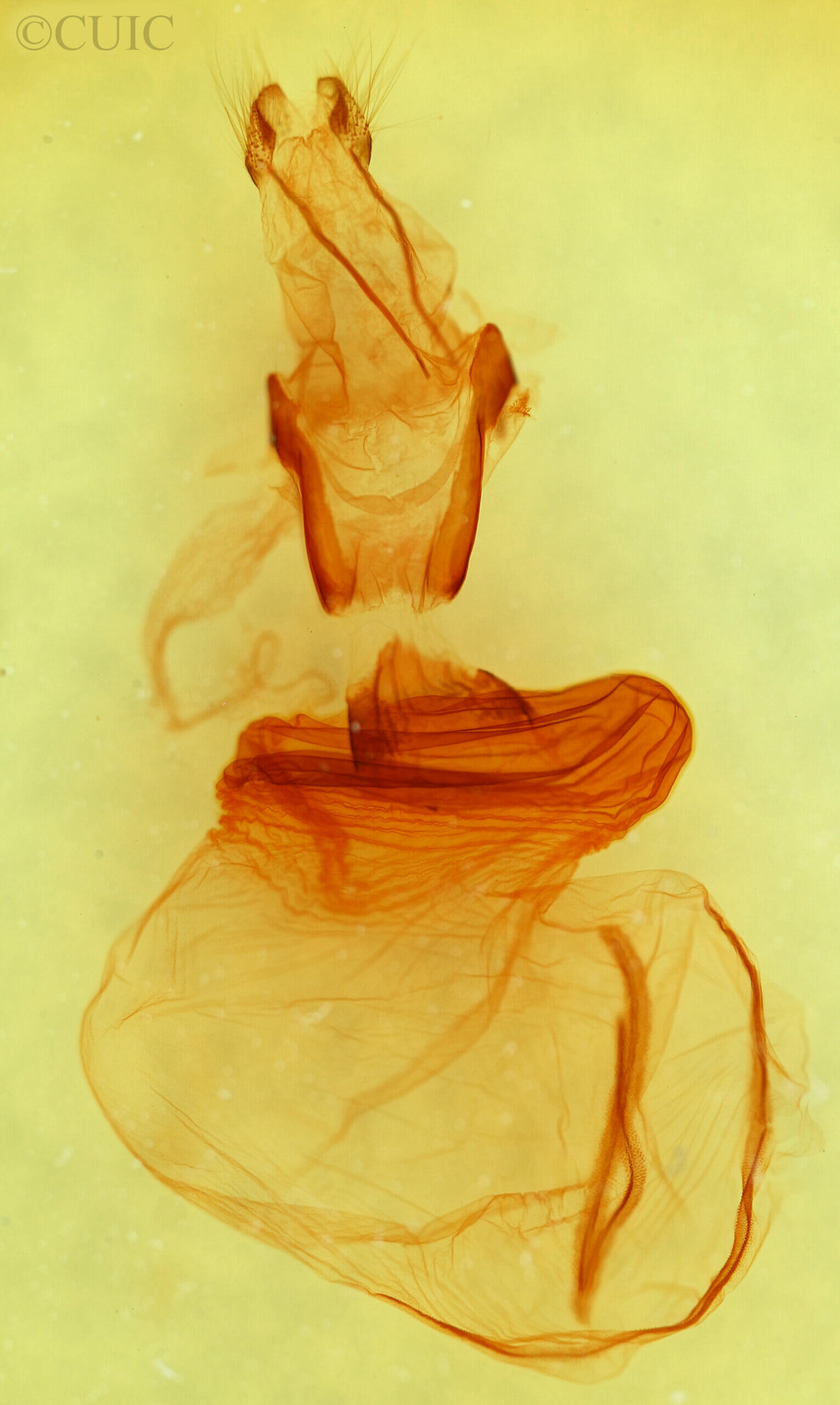 genitalia view of adult Xylena thoracica?