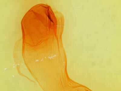 genitalia view of adult Xylena brucei