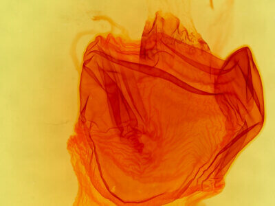 genitalia view of adult Xylena cineritia mertena