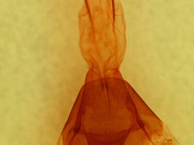 genitalia view of adult Brachlylomia discinigra?