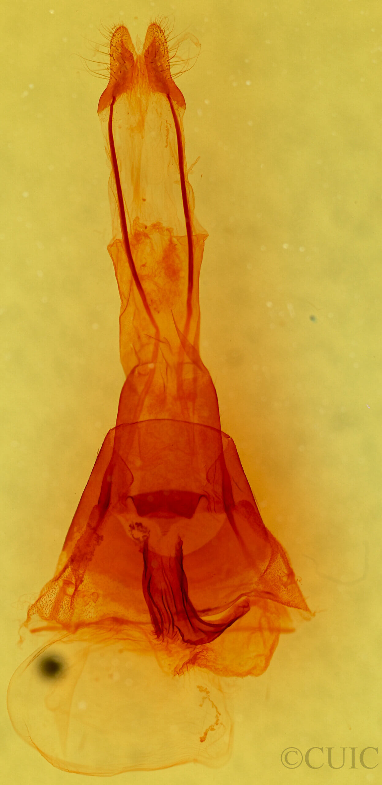 genitalia view of adult Brachylomia algens