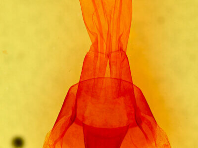 genitalia view of adult Brachylomia discinigra