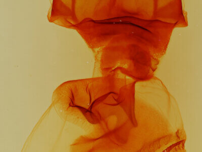 genitalia view of adult Nystalea eutalanta