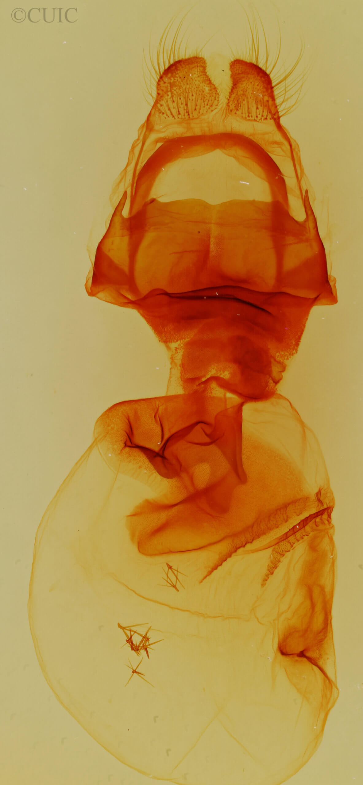 genitalia view of adult Nystalea eutalanta