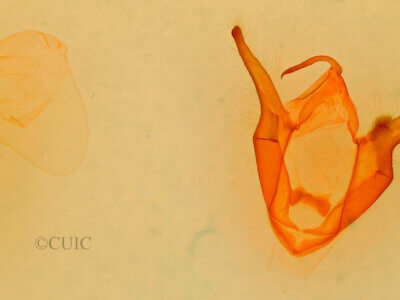 genitalia view of adult Zale rubi