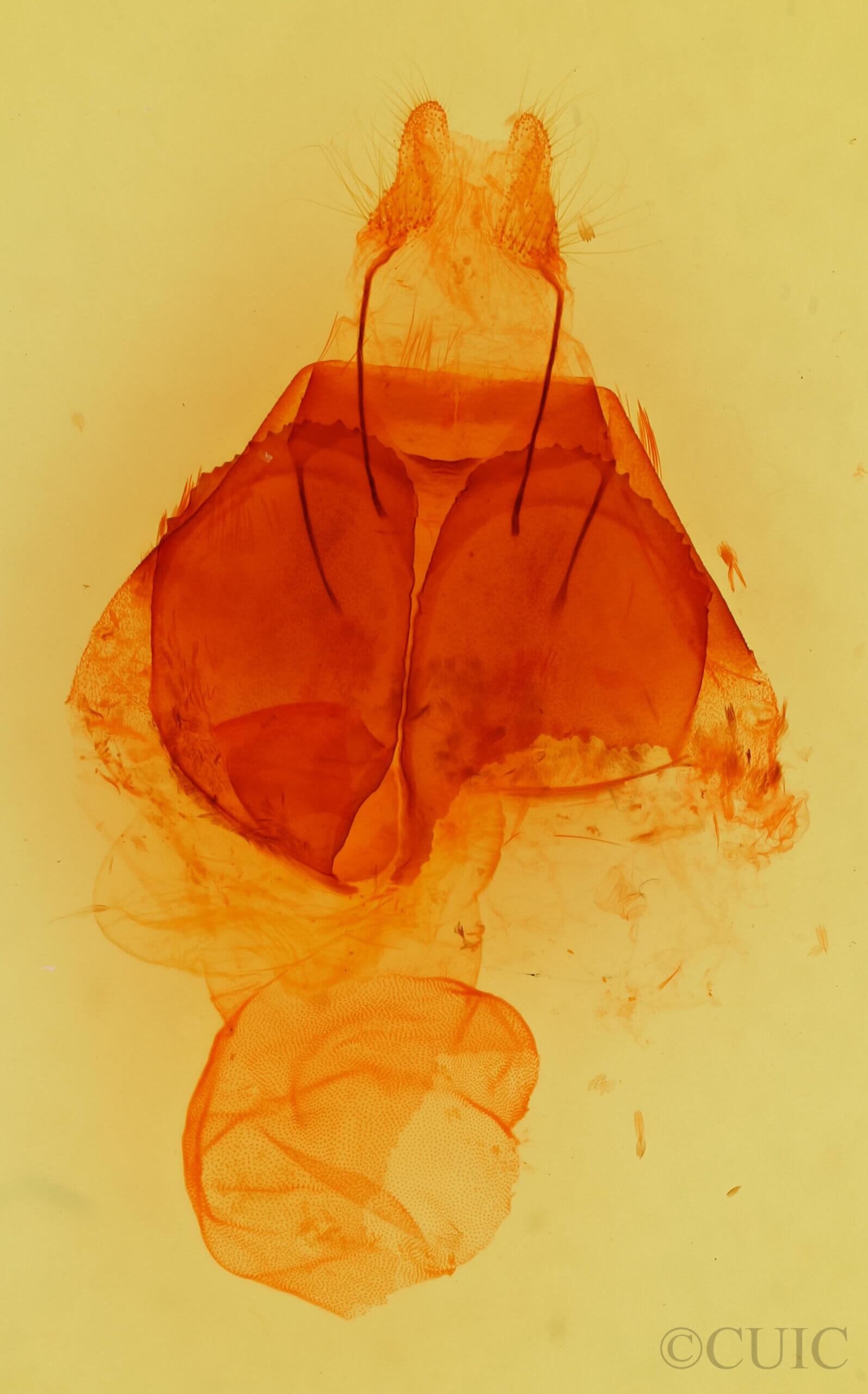 genitalia view of adult Zale rubi