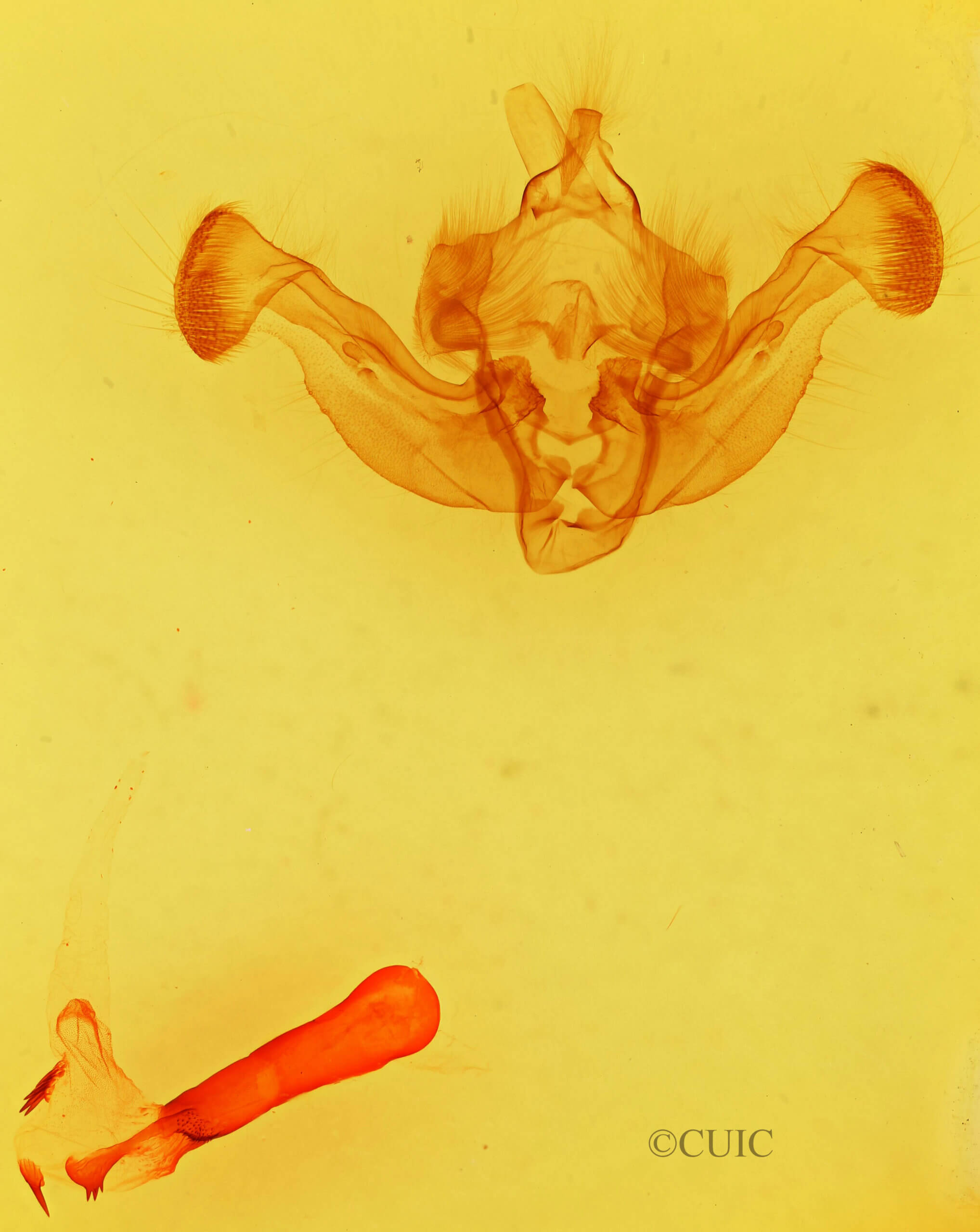 genitalia view of adult Luperina sp.