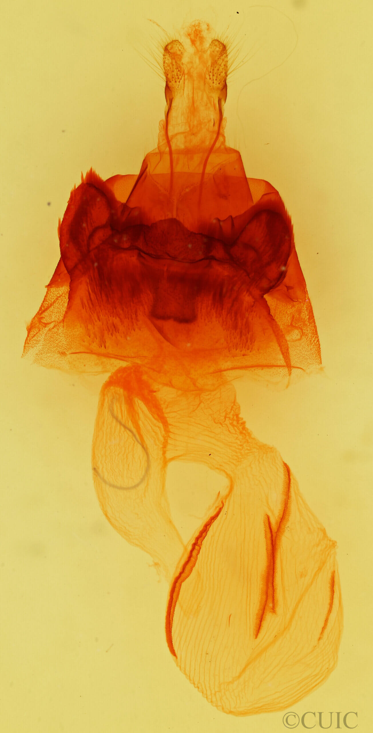genitalia view of adult Hyppa contrasta