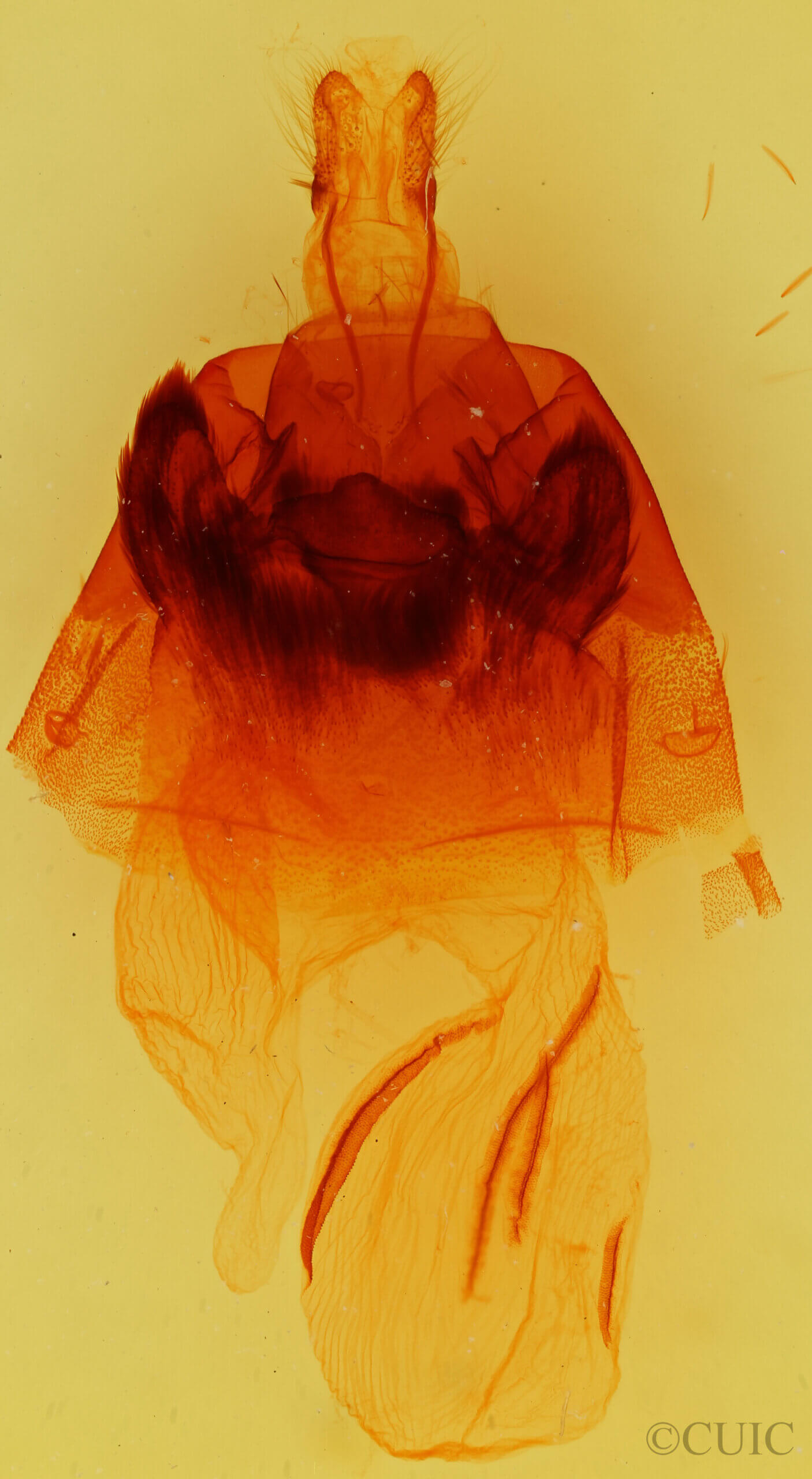 genitalia view of adult Hyppa contrasta