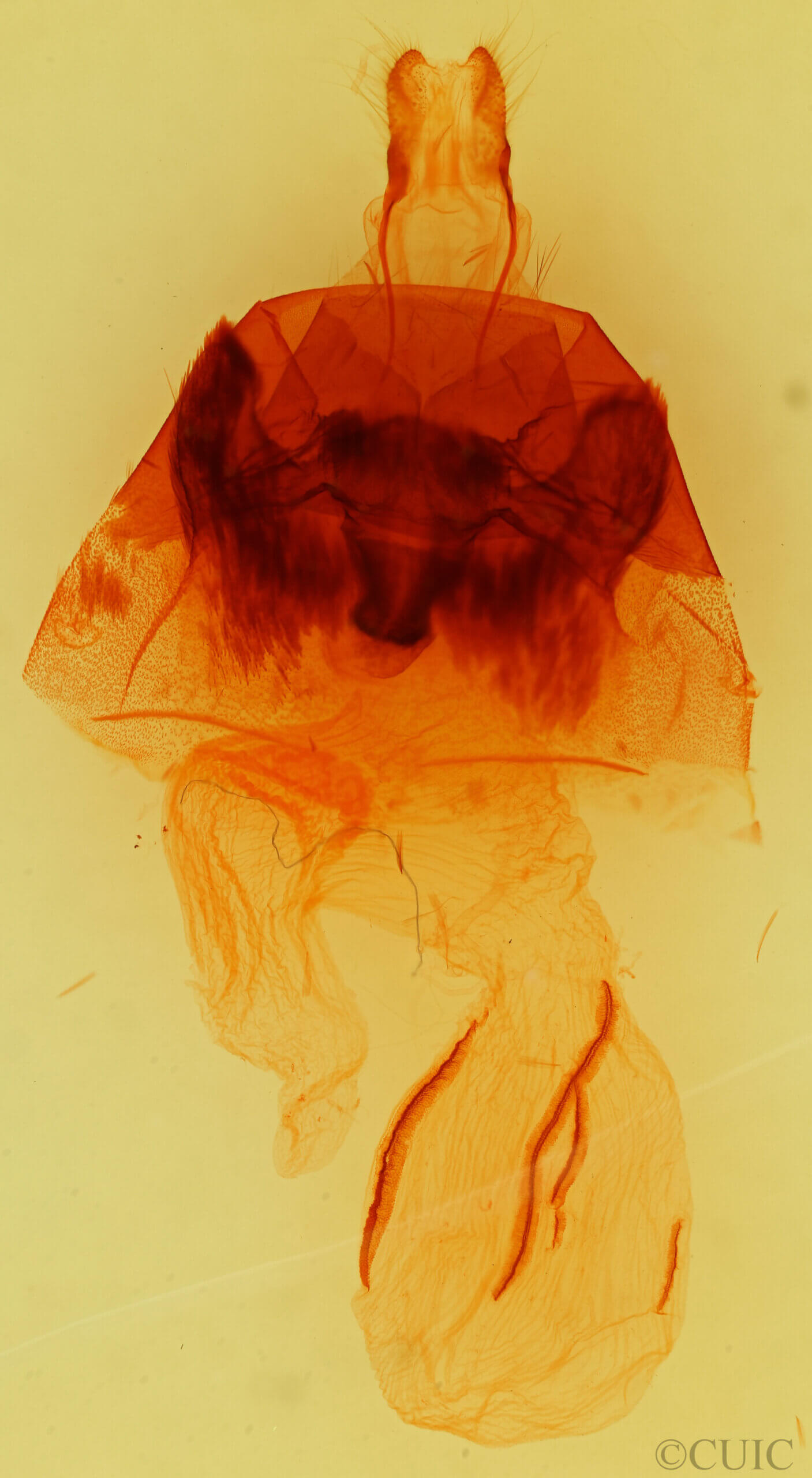 genitalia view of adult Hyppa contrasta